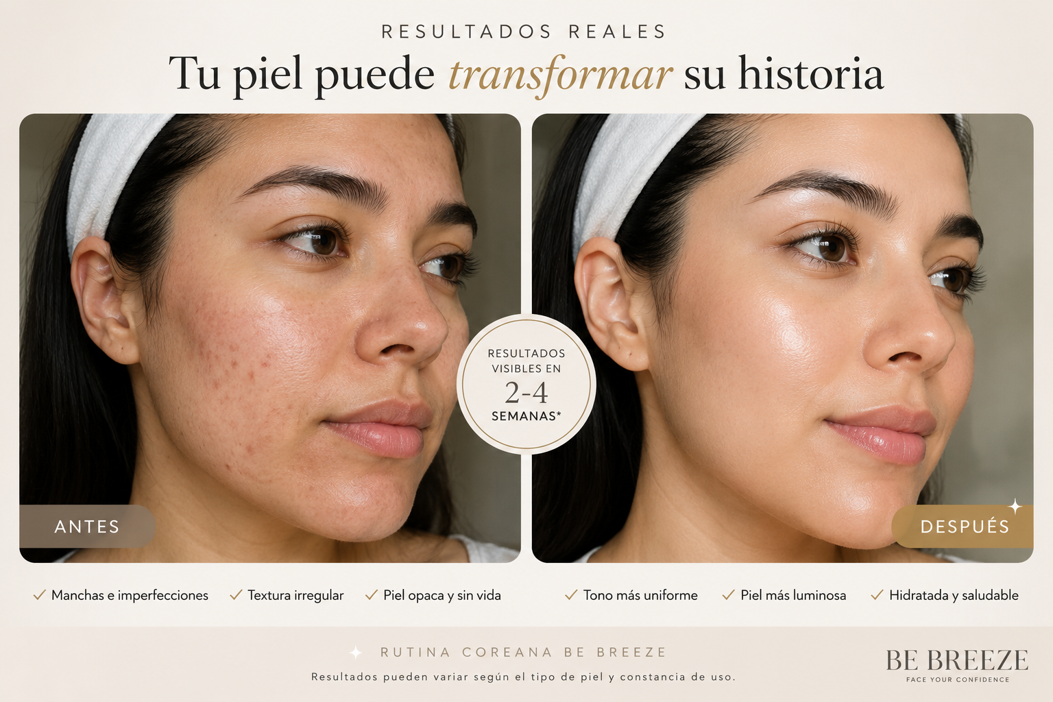 Resultados reales Be Breeze Beauty